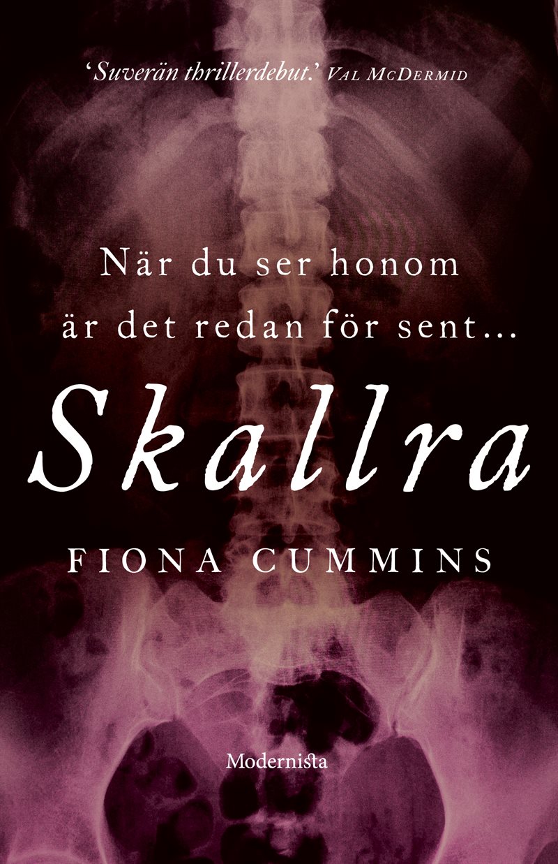 Skallra