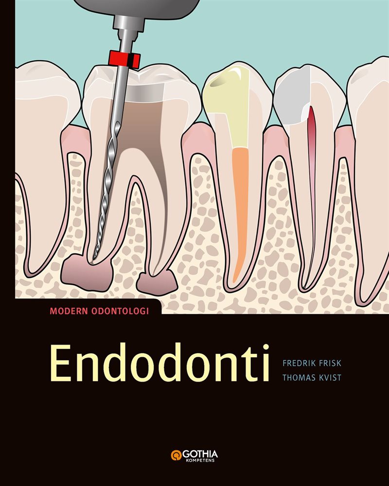 Endodonti