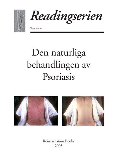 Den naturliga behandlingen av psoriasis